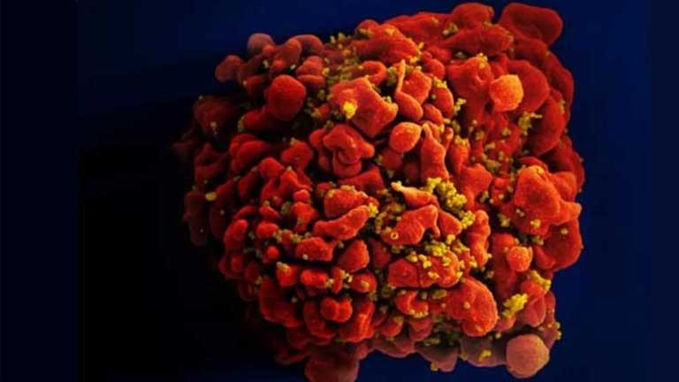 NIH launches clinical trial of three mRNA HIV vaccines