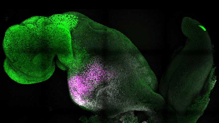 ‘Synthetic’ embryo with brain and beating heart grown from stem cells by Cambridge scientists