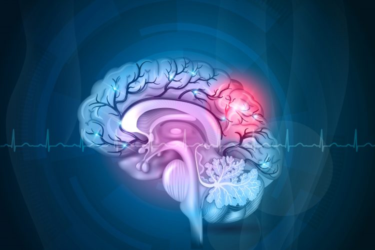 New stem cell approach could repair stroke-damaged brains